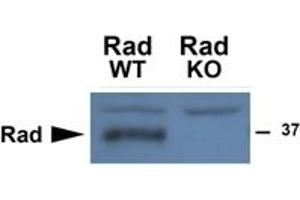 Western Blotting (WB) image for anti-Ras-Related Associated with Diabetes (RRAD) (Internal Region) antibody (ABIN2465070) (RRAD Antikörper  (Internal Region))