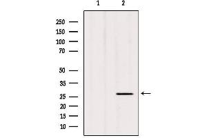 Western blot analysis of extracts from hybridoma cells, using C1QL3 Antibody. (C1QL3 Antikörper  (Internal Region))