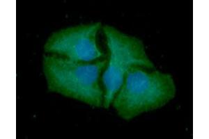 ICC/IF analysis of SMAC in HeLa cells line, stained with DAPI (Blue) for nucleus staining and monoclonal anti-human SMAC antibody (1:100) with goat anti-mouse IgG-Alexa fluor 488 conjugate (Green). (DIABLO Antikörper  (AA 56-239))