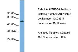 WB Suggested Anti-TUBB4  Antibody Titration: 0. (TUBB4 Antikörper  (N-Term))