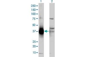 Western Blot analysis of AKR1C2 expression in transfected 293T cell line by AKR1C2 polyclonal antibody (A01).