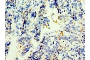 Immunohistochemistry of paraffin-embedded human lung tissue using ABIN7173394 at dilution of 1:100 (TGS1 Antikörper  (AA 714-853))