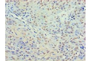 Immunohistochemistry (IHC) image for anti-Histone Deacetylase 3 (HDAC3) (AA 1-428) antibody (ABIN7155310)