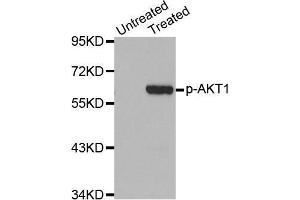 Western Blotting (WB) image for anti-V-Akt Murine Thymoma Viral Oncogene Homolog 1 (AKT1) (pSer473) antibody (ABIN6225474) (AKT1 Antikörper  (pSer473))