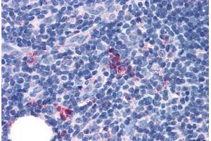 Anti-GPR97 antibody  ABIN1048901 IHC staining of human thymus, medulla. (GPR97 Antikörper  (Extracellular Domain))