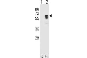 Western Blotting (WB) image for anti-Activin Receptor Type I (ACRV1) antibody (ABIN3003503)