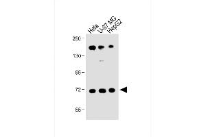 All lanes : Anti-FBXL5 Antibody (N-term) at 1:1000 dilution Lane 1: Hela whole cell lysate Lane 2: U-87 MG whole cell lysate Lane 3: HepG2 whole cell lysate Lysates/proteins at 20 μg per lane.