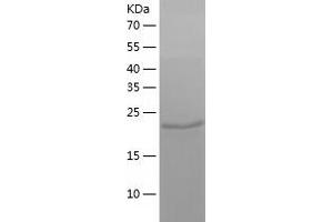 Western Blotting (WB) image for Nucleoside Diphosphate Kinase (NME7) (AA 1-228) protein (His tag) (ABIN7124226)