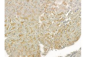 ABIN6261640 and ABIN6276821 at 1/100 staining human normal liver tissue by IHC-P. (F12 Antikörper  (C-Term))