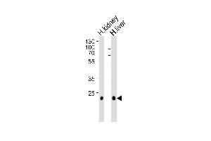 Western blot analysis of lysates from human kidney and liver tissue lysate (from left to right), using CLDN14 Antibody (C-term) (ABIN1881208 and ABIN2838931). (CLDN14 Antikörper  (C-Term))