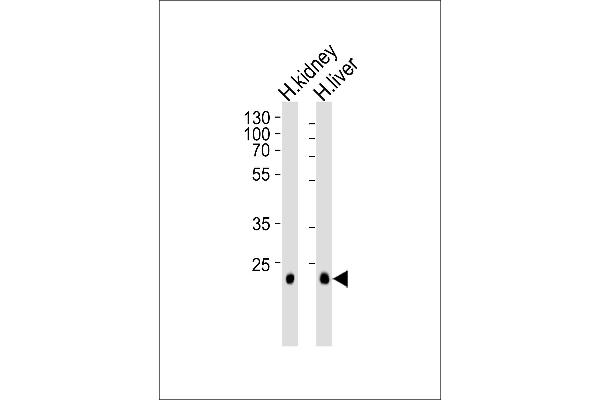 CLDN14 Antikörper  (C-Term)