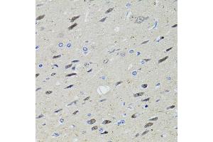Immunohistochemistry of paraffin-embedded rat brain using STAT1 antibody (ABIN1874962) at dilution of 1:100 (40x lens). (STAT1 Antikörper)