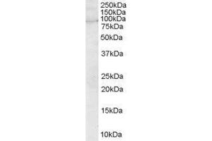 Western Blotting (WB) image for rho Guanine Nucleotide Exchange Factor (GEF) 4 (ARHGEF4) peptide (ABIN370384)