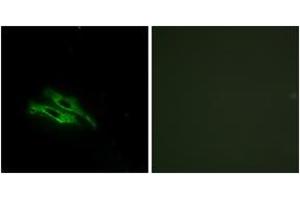 Immunofluorescence analysis of NIH-3T3 cells, using THRB Antibody. (THRB Antikörper  (AA 391-440))