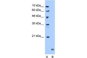 WB Suggested Anti-CRYAB Antibody Titration:  5. (CRYAB Antikörper  (C-Term))
