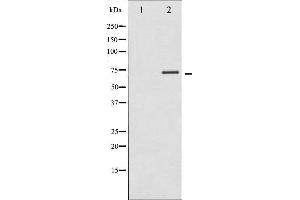 Western blot analysis of p70 S6 Kinase phosphorylation expression in Insulin treated Jurkat whole cell lysates,The lane on the left is treated with the antigen-specific peptide. (RPS6KB1 Antikörper  (pThr389, pThr412))