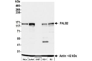 anti-Partner and Localizer of BRCA2 (PALB2) (AA 350-400) antibody