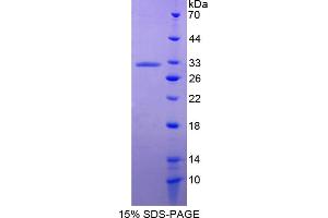 Image no. 1 for Annexin A6 (ANXA6) (AA 2-251) protein (His tag) (ABIN4989176) (ANXA6 Protein (AA 2-251) (His tag))