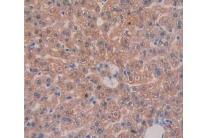 IHC-P analysis of liver tissue, with DAB staining. (Integrin beta 3 Antikörper  (AA 135-377))