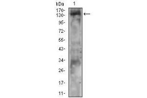 Phospholipase C gamma 2 Antikörper  (pTyr753)