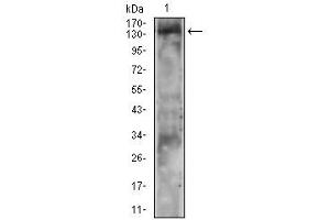 Western blot analysis using PLCG2 mouse mAb against A431 cell lysate.
