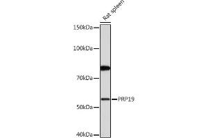 Western blot analysis of extracts of Rat spleen, using PRP19 Rabbit mAb (ABIN7269505) at 1:1000 dilution.