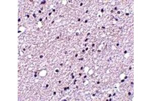 Immunohistochemistry (IHC) image for anti-Tachykinin Receptor 3 (TACR3) (Middle Region) antibody (ABIN1031019) (TACR3 Antikörper  (Middle Region))