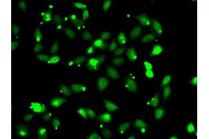 Immunofluorescence analysis of HeLa cells using C1S antibody (ABIN6290127). (C1S Antikörper)