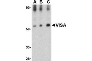 Western blot analysis of VISA in rat brain tissue lysate with this product at (A) 0.