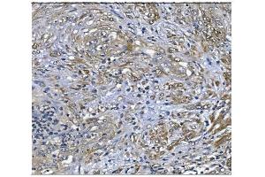 IHC analysis of PRDX6 using anti-PRDX6 antibody (ABIN7600102).