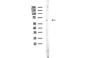 Western blot analysis of lysates from EC304 cells, using ICOSLG Antibody at 1/1000 dilution.