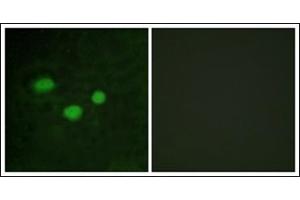 Immunofluorescence analysis of HeLa cells, using DNMT3B Antibody. (DNMT3B Antikörper  (N-Term))