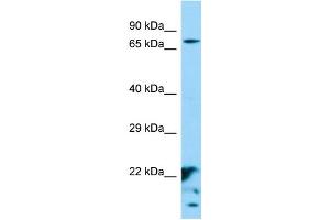 Western Blotting (WB) image for anti-XK, Kell Blood Group Complex Subunit-Related Family, Member 6 (XKR6) (Middle Region) antibody (ABIN2790600) (XKR6 Antikörper  (Middle Region))
