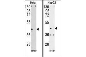 Western blot analysis of anti-hPGK1 pab pre-incubated with and without blocking peptide in Hela (LEFT) and HepG2 (RIGHT) cell line lysate.