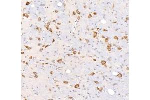 Immunohistochemistry analysis of paraffin-embedded rat brain using,KCNG3 (ABIN7075157) at dilution of 1: 2000 (KCNG3 Antikörper)