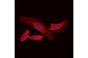 Immunofluorescent analysis of CHSY2 staining in A549 cells. (CHPF Antikörper  (C-Term))