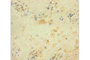 Immunohistochemistry of paraffin-embedded human placenta tissue using ABIN7154468 at dilution of 1:100 (GADD45B Antikörper  (AA 1-160))