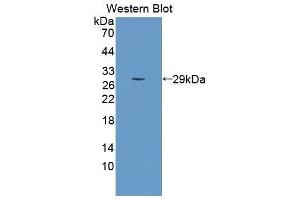 Western Blotting (WB) image for anti-Sema Domain, Seven Thrombospondin Repeats (Type 1 and Type 1-Like), Transmembrane Domain (TM) and Short Cytoplasmic Domain, (Semaphorin) 5B (SEMA5B) (AA 350-602) antibody (ABIN5662014)