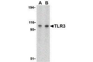 Western Blotting (WB) image for anti-Toll-Like Receptor 3 (TLR3) (C-Term) antibody (ABIN2479740) (TLR3 Antikörper  (C-Term))