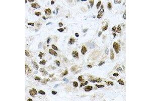 Immunohistochemical analysis of UBE2B staining in rat lung formalin fixed paraffin embedded tissue section.