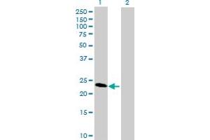 Western Blot analysis of SECTM1 expression in transfected 293T cell line by SECTM1 MaxPab polyclonal antibody. (SECTM1 Antikörper  (AA 29-248))