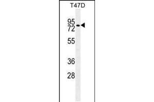 Western blot analysis in T47D cell line lysates (35ug/lane). (ZFP69 Antikörper  (C-Term))