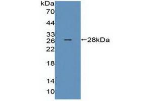 Detection of Recombinant MED1, Human using Polyclonal Antibody to Mediator Complex Subunit 1 (MED1) (MED1 Antikörper  (AA 1-212))