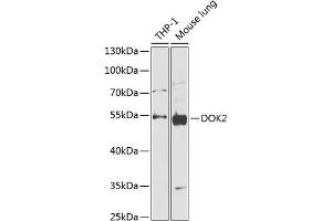 Western blot analysis of extracts of various cell lines, using DOK2 antibody (ABIN6130308, ABIN6139765, ABIN6139767 and ABIN6218320) at 1:1000 dilution. (DOK2 Antikörper  (AA 1-260))