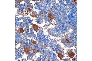Immunohistochemistry of paraffin-embedded mouse bone marrow using CXCL4/CXCL4/PF4 Rabbit mAb (ABIN1683188, ABIN3017983, ABIN3017984 and ABIN7101555) at dilution of 1:100 (40x lens). (PF4 Antikörper)
