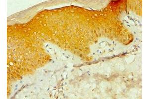 Immunohistochemistry of paraffin-embedded human skin tissue using ABIN7146856 at dilution of 1:100