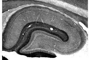 Adult rat hippocampus immunohistochemistry. (ADAM22 Antikörper  (Cytosolic))