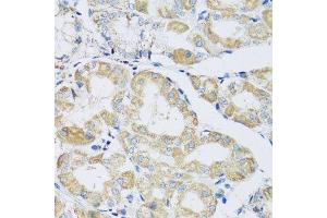 Immunohistochemistry of paraffin-embedded human stomach using ATPIF1 antibody. (ATPase Inhibitory Factor 1 Antikörper  (AA 26-106))