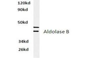 Image no. 2 for anti-Aldolase B, Fructose-Bisphosphate (ALDOB) antibody (ABIN317837)
