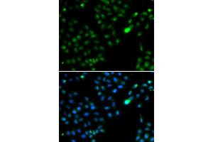 Immunofluorescence analysis of HeLa cell using FKBP3 antibody. (FKBP3 Antikörper)